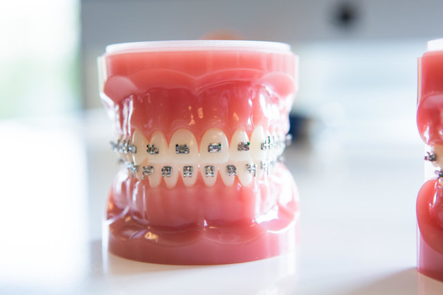 Freeman-Orthodontics-Braces-Treatment-37-thegem-blog-masonry 