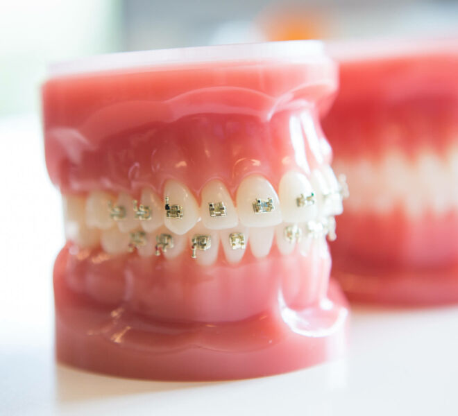 Freeman-Orthodontics-Braces-Treatment-43-thegem-gallery-justified 