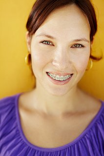 wpid-ortho-youngwoman-bracessmiling  - Braces and Invisalign in San Jose California - Freeman Orthodontics