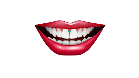 matt-freeman-orthodontics-smile-width-adjustedb 